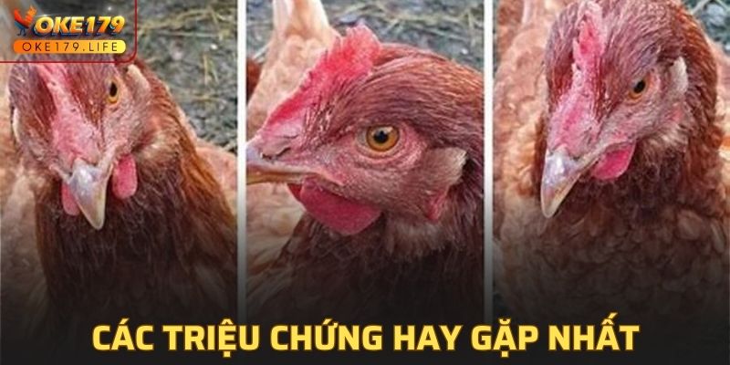 Các triệu chứng hay gặp nhất