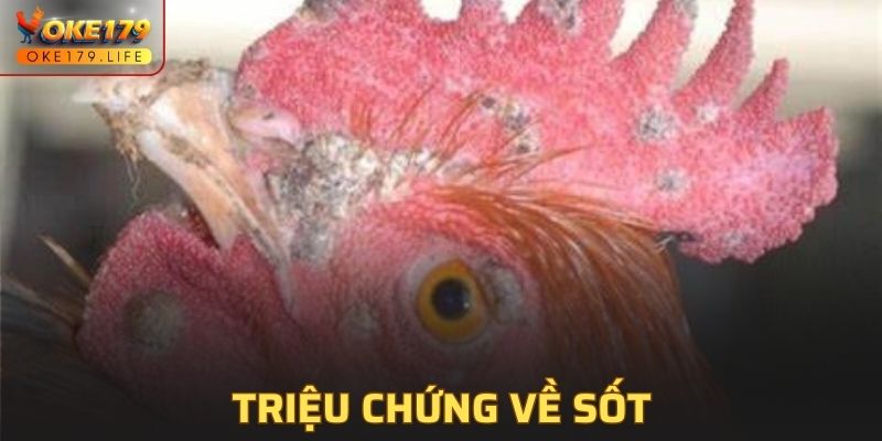 Triệu chứng phổ biến của sốt cao