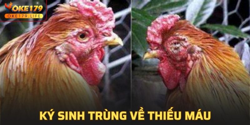 Bệnh ký sinh trùng đường máu do sốt rét