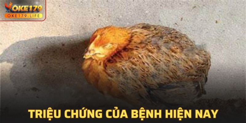 Triệu chứng thường thấy nhất hiện nay