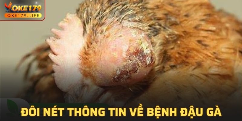 Đôi nét thông tin về bệnh đậu gà